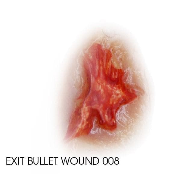 SILICONE MOULD- EXIT BULLET WOUND