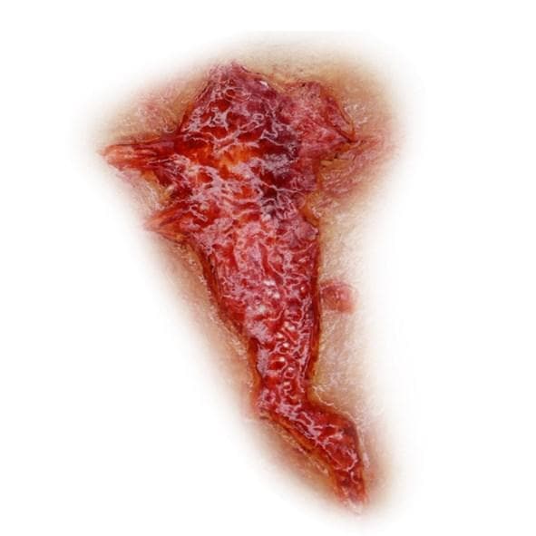 SILICONE MOULD- FLESH WOUND 009 SILICONE MOULD- FLESH WOUND 009