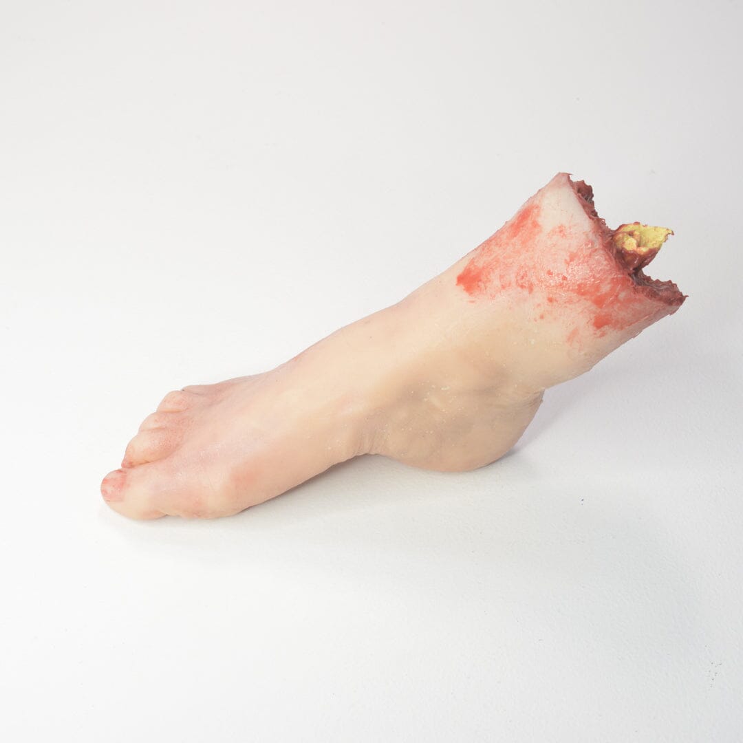 Amputated Foot